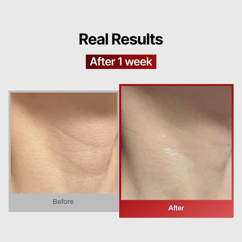 Neck Wrinkle Patches - Firming Korean Collagen Masks for Lifting Sagging Skin | 7 Pack