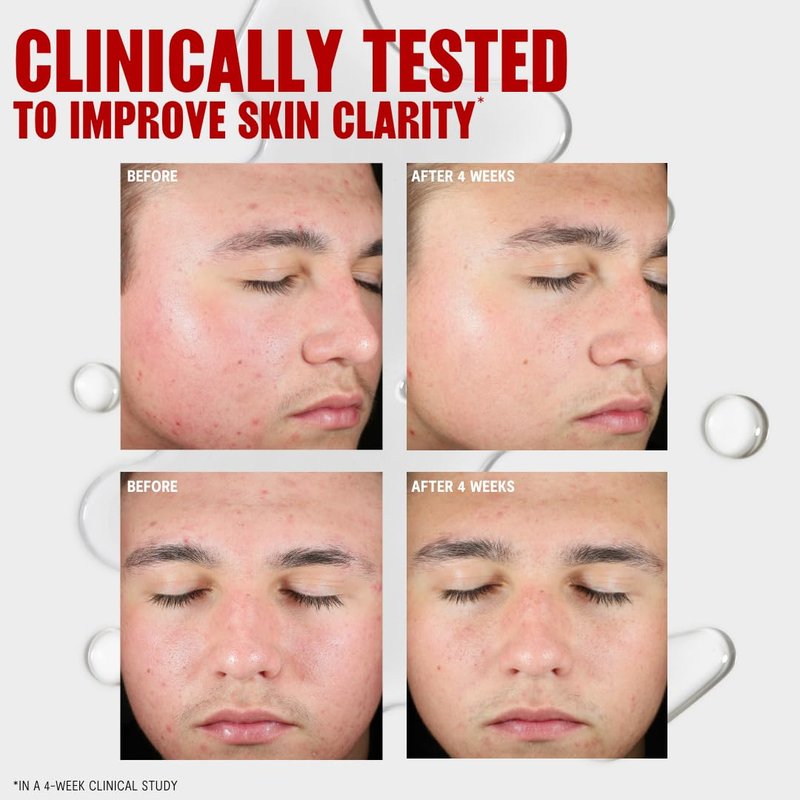 Thayers Blemish Clearing Toner - 2% Salicylic Acid Acne Treatment | Soothing Skin Care, 12 Fl Oz