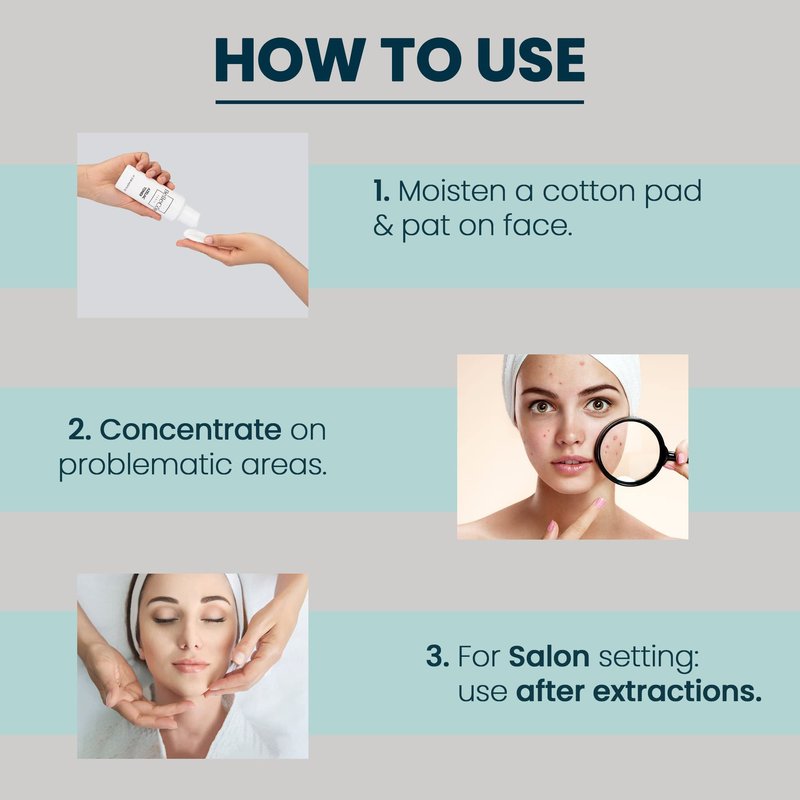 Azelaic Acid Acne Treatment Toner -10% Azelaic + 2% Salicylic Acid Serum for Face - Rosacea & Blackhead Care Best Acne Treatment for Women - Oil Control for Clear Skin - 4oz