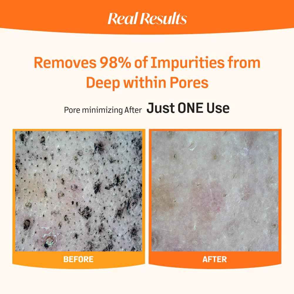 Pumpkintinol Pore Deep Gum Cleanser | Face Cleanser & Mask in One | Gentle Exfoliation with Rice Bran Powder | Deep Cleansing, Pore Care, & Radiance Boosting (120ml / 4.05 fl. oz.)