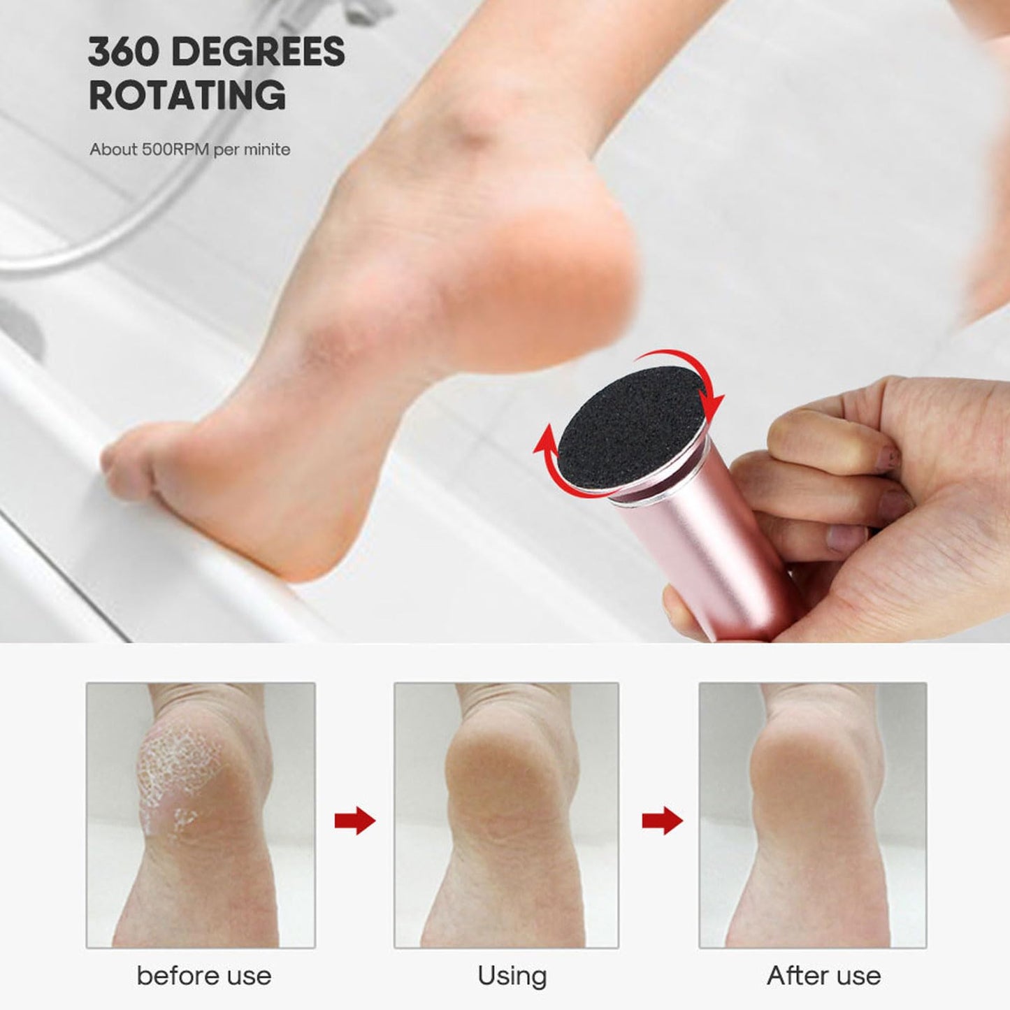 Electric Foot Callus Remover Kit,Electric Foot Callus Remover Foot Dead Skin Filer Pedicure Tool with Adapter And Sandpaper Discs