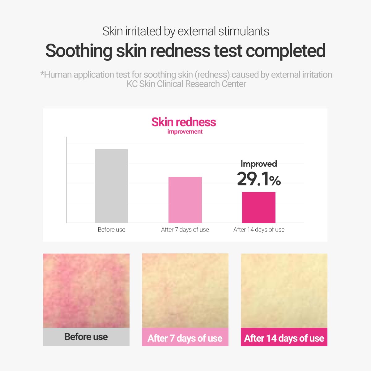 ROVECTIN Cica Care Blemish Clearing Cream: Soothes skin irritation and improves oiliness, sebum, blackheads For Oily Skin | Calamine, Centella Asiatica | Vegan Korean Moisturizer (1.69 fl.oz, 50ml)
