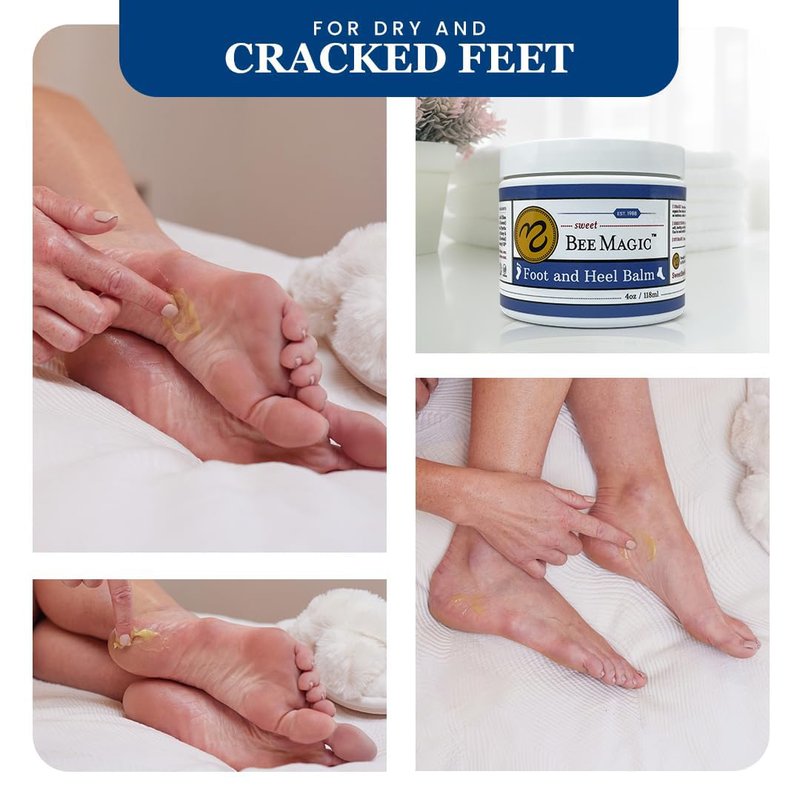 Sweet Bee Naturals Organic Foot Balm - Intensive Heel Balm for Dry Cracked Feet - Natural Moisturizing Treatment for Cracked Heels - Heel Cream Softener for Rough Skin Repair – 4 OZ Jar