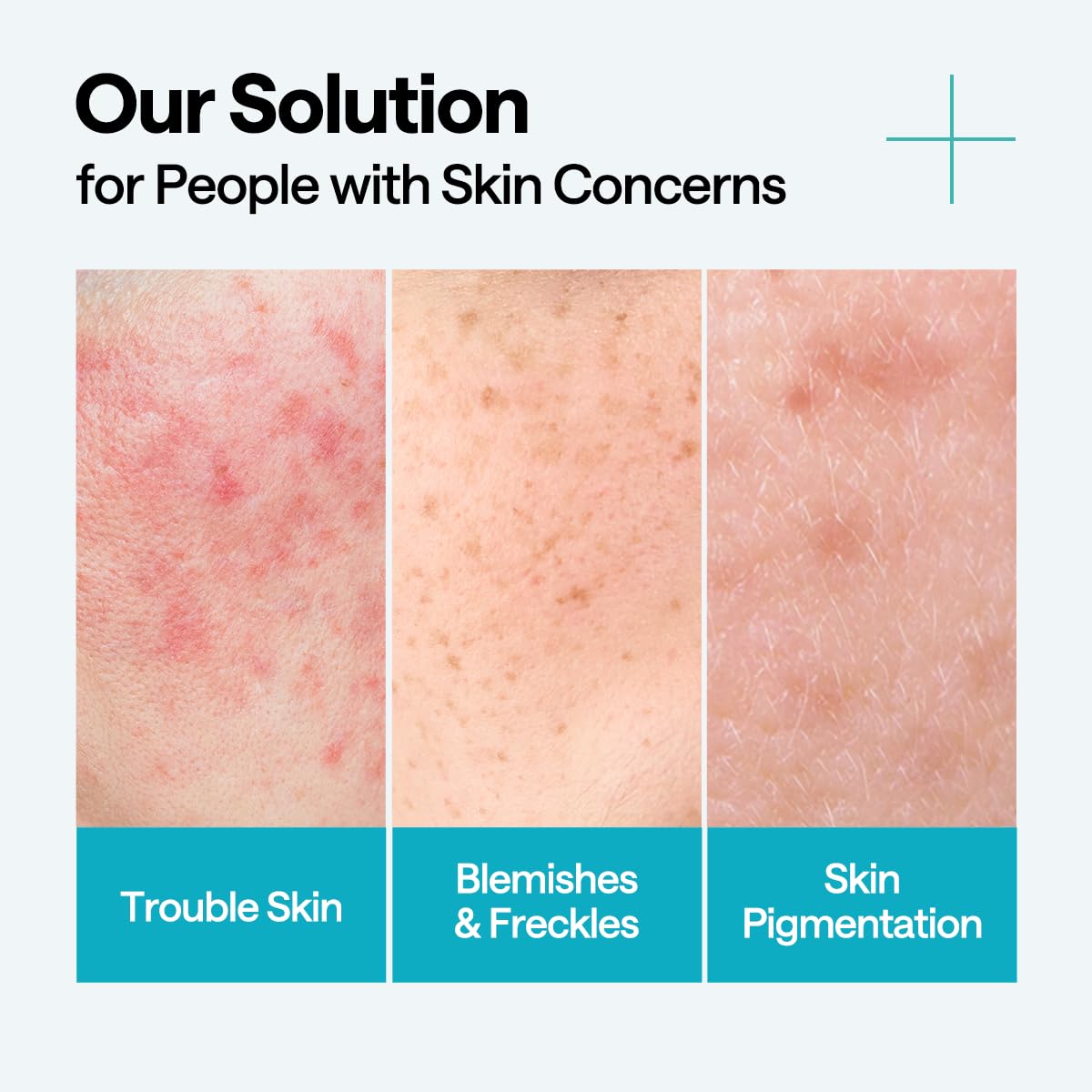 Madecassoside Repair Serum - Blemish Care & Skin Soothing | Centella Asiatica & Niacinamide, 1.35 fl. oz.