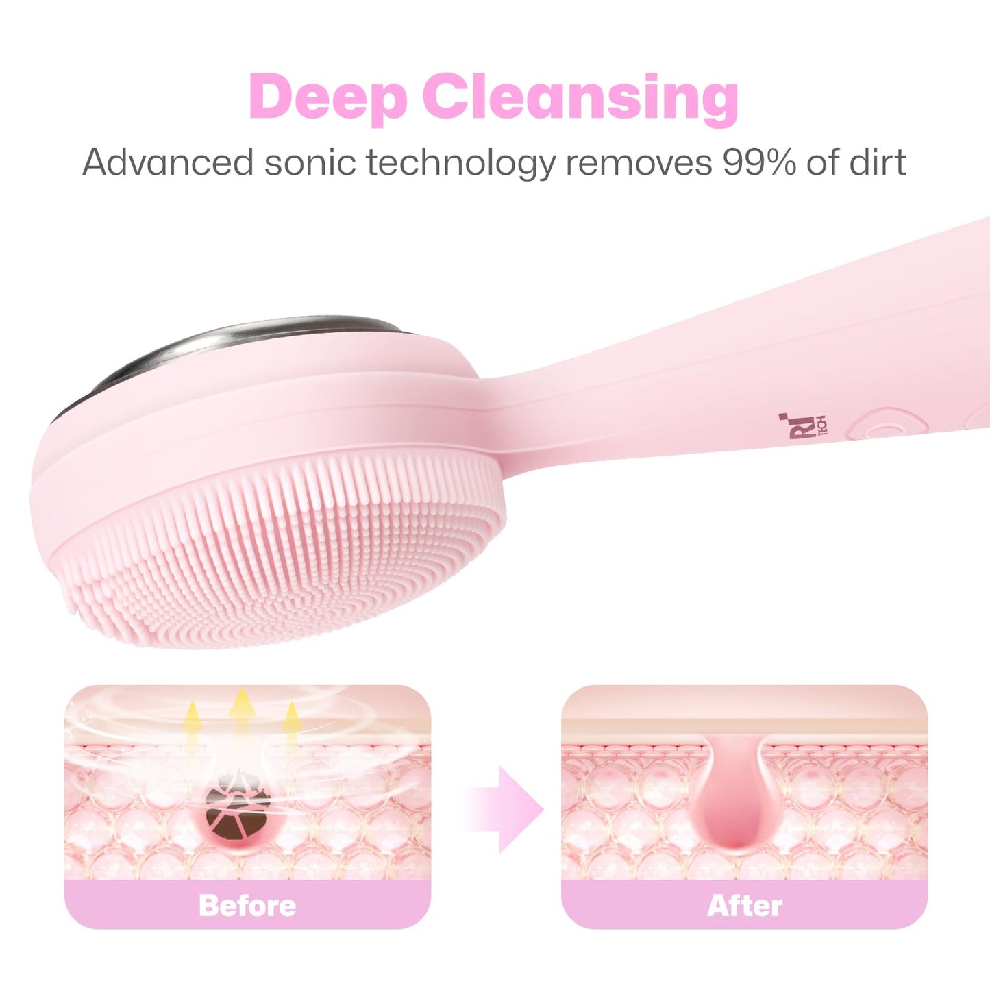 PRITECH Facial Cleansing Brush with Vibrating, Rechargeable Silicone Face Scrubber for Deep Pore Cleaning, Exfoliator & Waterproof Face Brush with Heat End for for Women and Men (Pink)