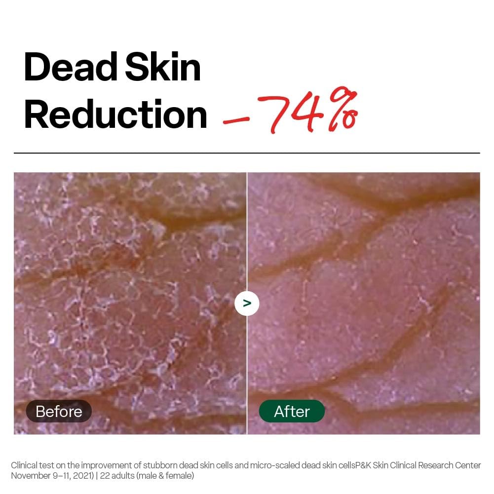 Dr. G Brightening Peeling Gel - Korean Skincare for Glowy Skin - Aqua Gommage Facial Exfoliator - Hyaluronic Acid, Ceramides, Vitamin C - Smooth Skin Texture, Low Irritation - Bulk Items - 4.23 fl oz