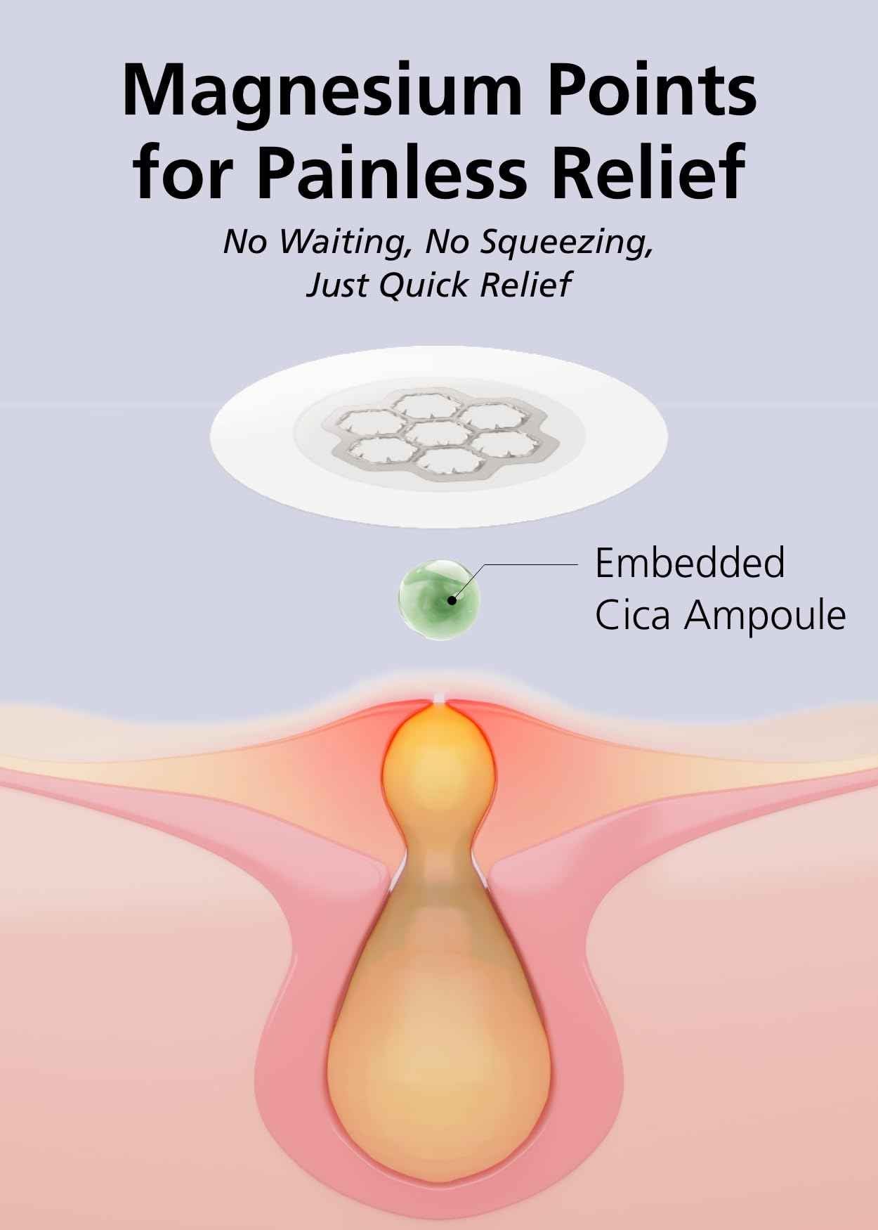 EasyDerm Quick Calming Magnesium Patches – Hydrocolloid Acne Spot Treatment Includes Tweezers & Ampoule, 10 Patches, Zit Sticker, Made by Daewoong Pharmaceutical