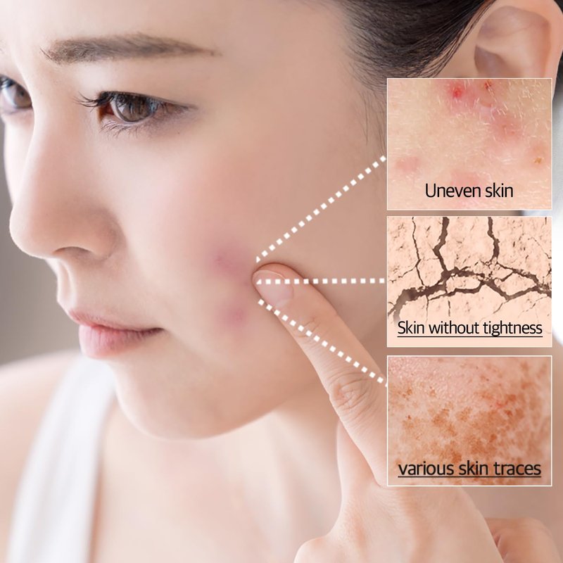 MEDIPICKME Centella Asiatica Soothing Gel Cream – 68% Madagascar Cica Madecassoside Daily Moisturizer for Sensitive Skin – Calming Face Cream with Ceramide – Fragrance Free Korean Skincare
