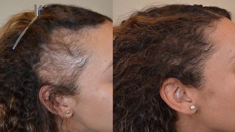 Hair Growth Oil - 34-in-1 Fast-Track Formula for Rapid Growth | Moisturizing Blend of Exotic Oils & Botanicals - 2 fl oz