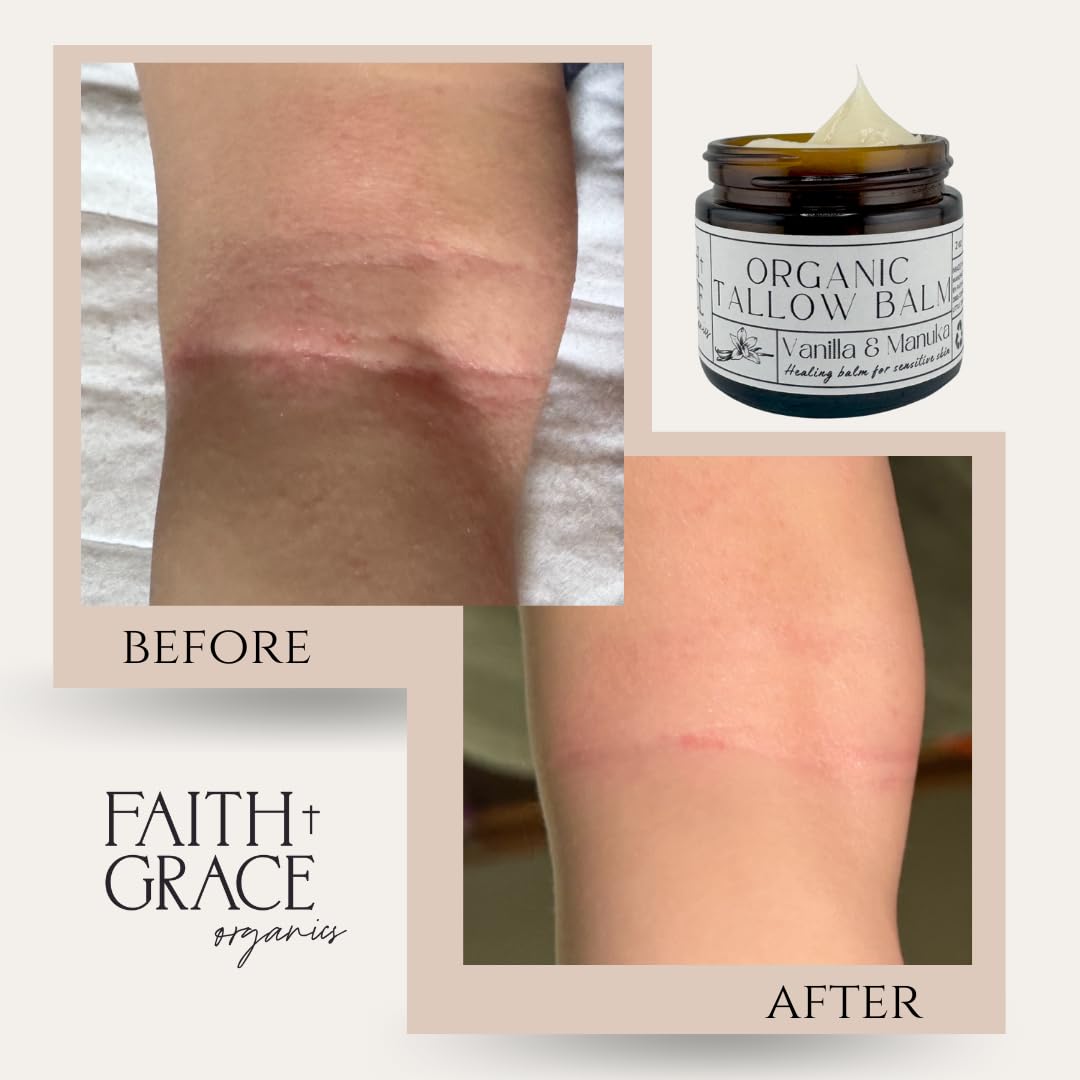 Beef Tallow Balm for Skin - Organic Moisturizer with Vanilla & Manuka Honey | 2 oz All-Purpose Cream