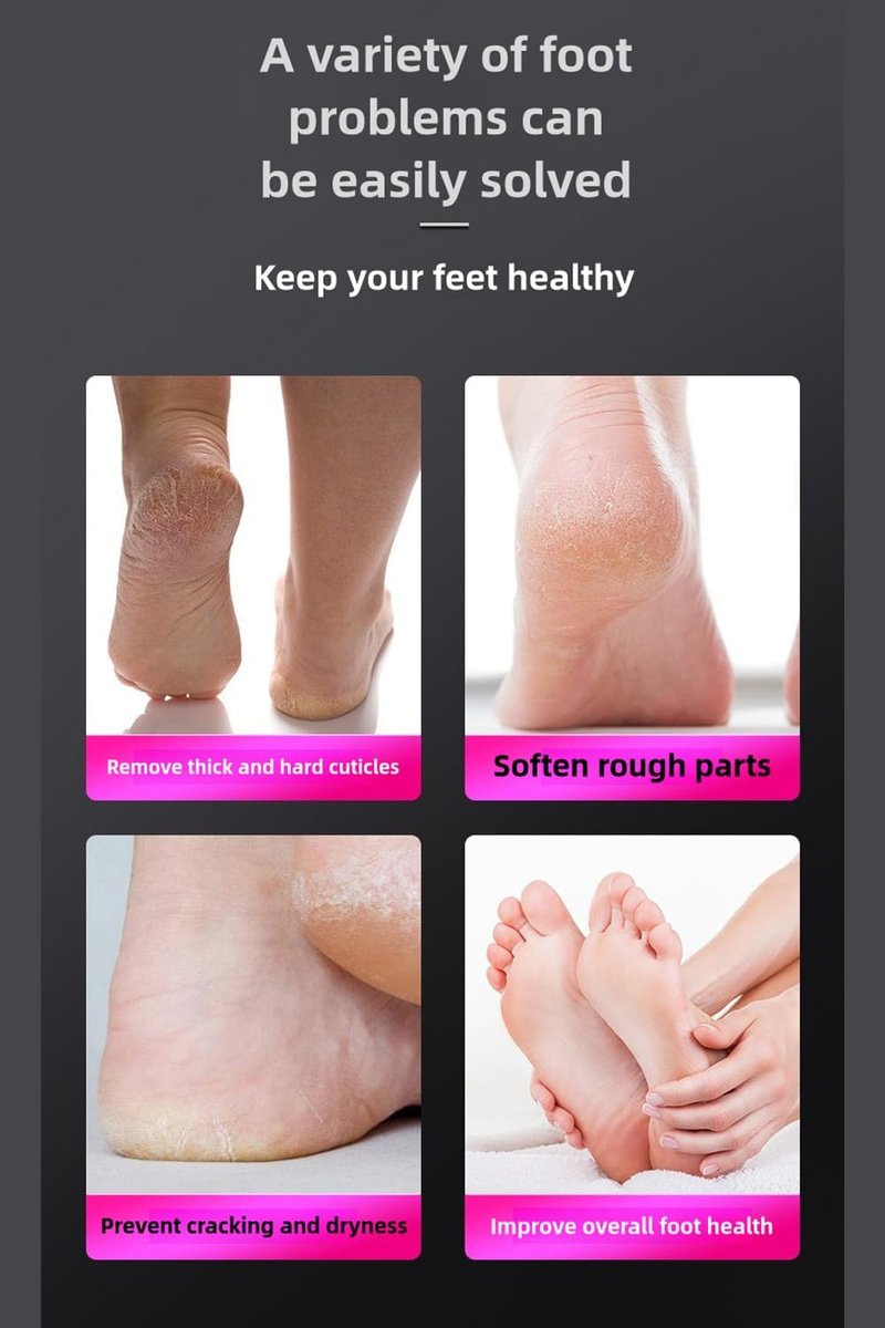 Electric Foot Callus Remover - 9-Speed Pedicure Tool with Dual Heads & LCD Display | Portable Type-C Charge