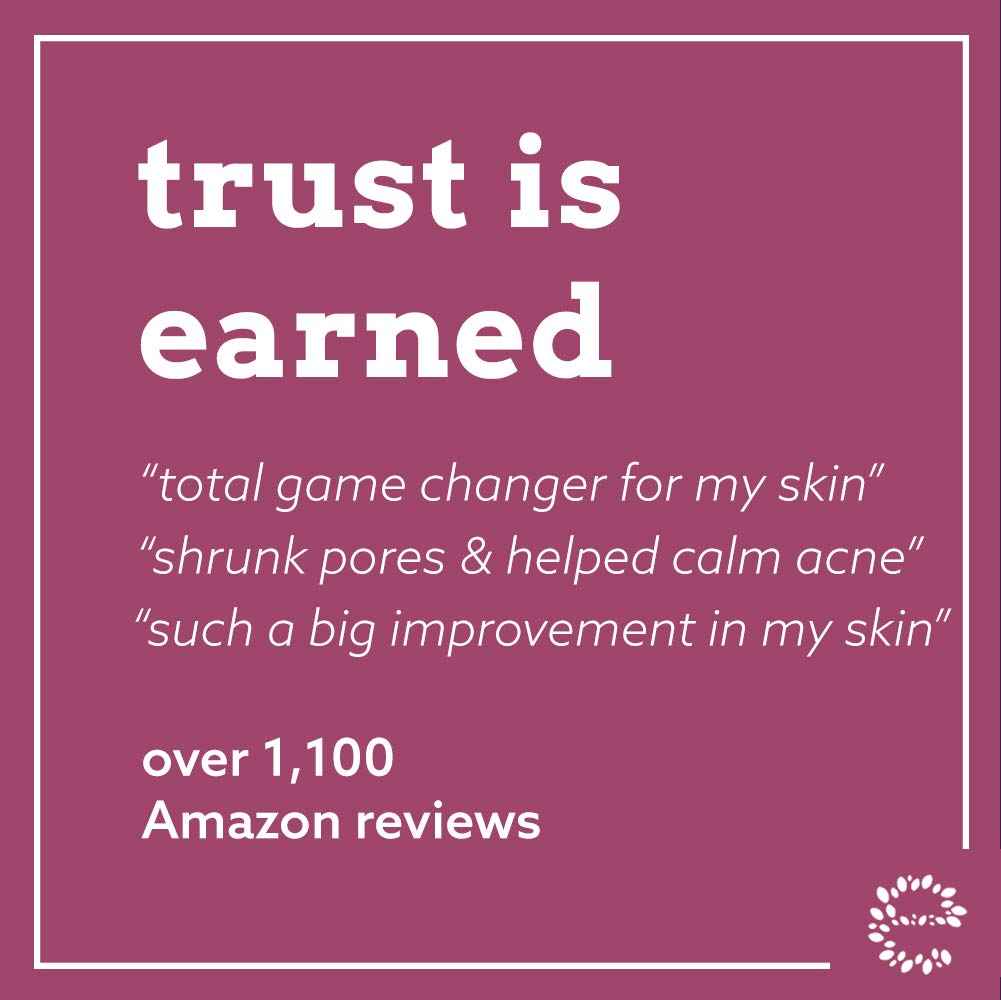 Eve Hansen Anti-Aging Retinol Serum for Face | Anti-Wrinkle Serum with Vitamin A, E, and Hyaluronic Acid | Acne Scar, Pore Minimizer Cruelty Free 2% Organic Retinol Night(1 oz)