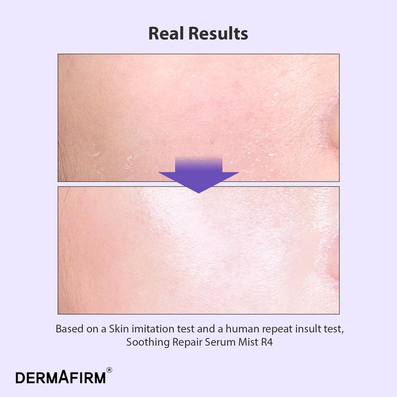 Dermafirm Soothing Repair Facial Serum Hydrating Mist R4 | Face Mist Hydrating Spray for Dark Spots w/Eucalyptus, Peptide & Collagen | Gentle for All Skin Types No Animal Trials No Paraben 3.38 fl oz