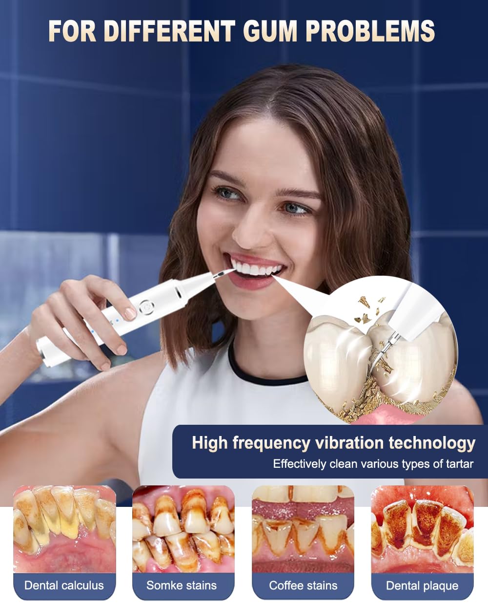 Spaunfit Plaque Remover for Teeth, Calculus Remover for Teeth Cleaning with 3 Modes and 4 Heads, Rechargeable Dental Calculus Remover Teeth Cleaning Kit for Home ASWE002, QG001, White