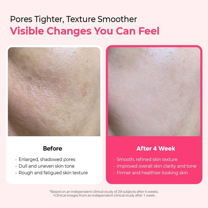 Dr.Melaxin Cyano Pink Spicule Serum - Vitamin B12 Microneedle Treatment for Enlarged Pores | 1.01 fl. oz