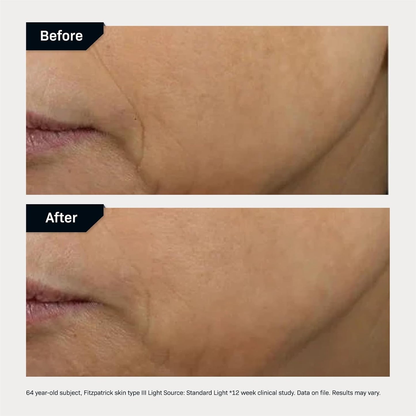Revision Skincare D·E·J Face Cream - Advanced Anti-Aging Moisturizer | Lifting, Firming & Antioxidant-Rich Formula