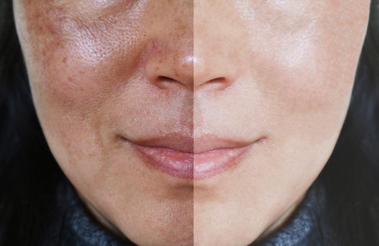 Vitality Precision Skin Retinol Peel Pads .5%- 3 month supply