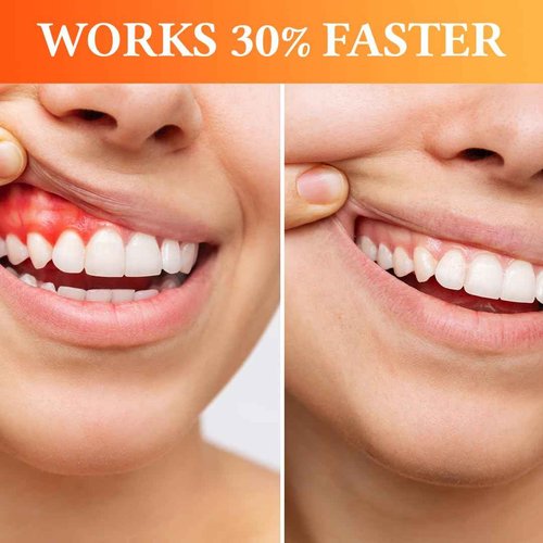 The Goodbye Company Natural Gum Health Oil - Supports 77% Gum Tissue Improvement, Pocket Depth Reduction & Tooth Retention with Organic Neem & Clove (30ml)