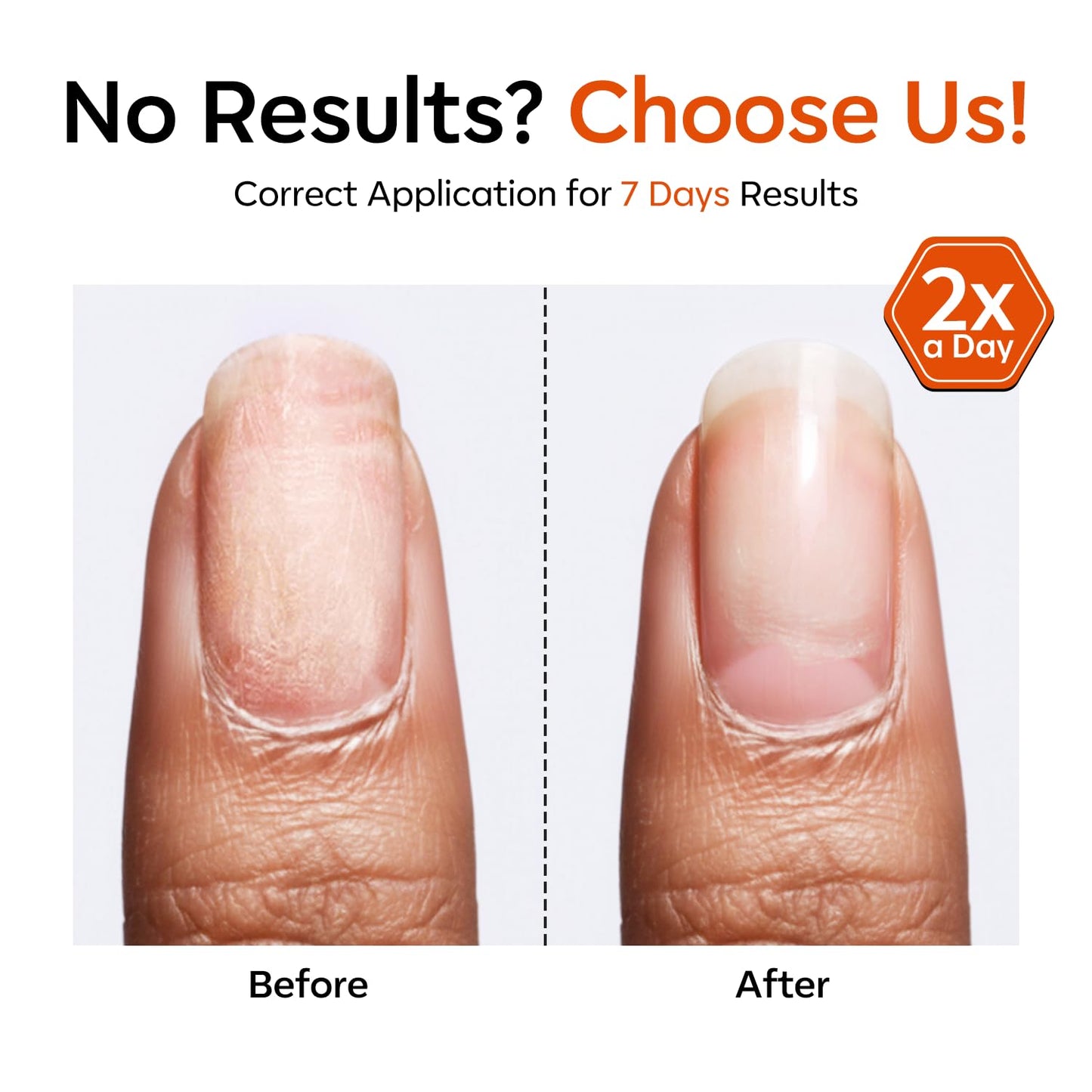 modelones Gel Nail Strengthener and Growth Scented Nail Repair for Damaged Nails Hardener Extra Strong and Growth 3-in-1 Repair Mode Gifts for WomenGel Nail Kit for Beginner