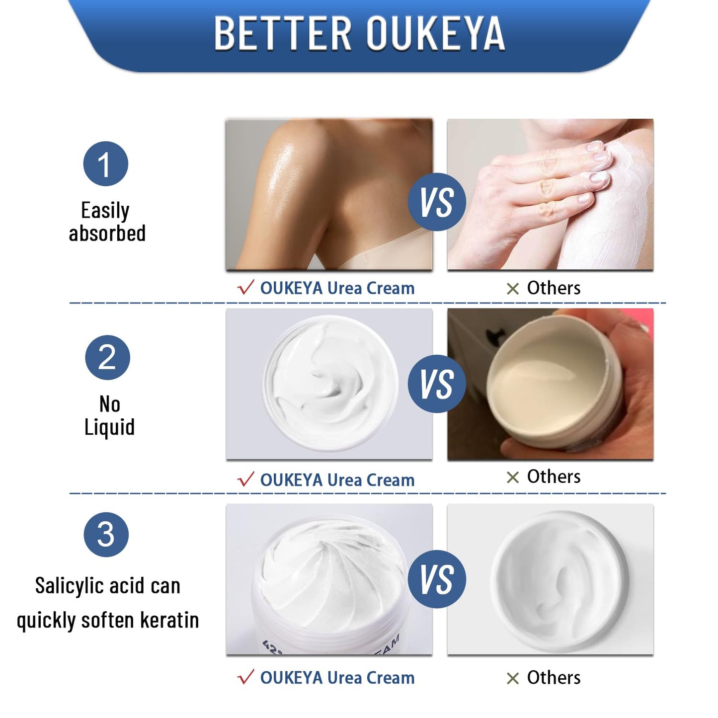 OUKEYA 42% Urea Cream to Soften & Smooth Dry, Rough Skin 5.29 oz, 2 Pack