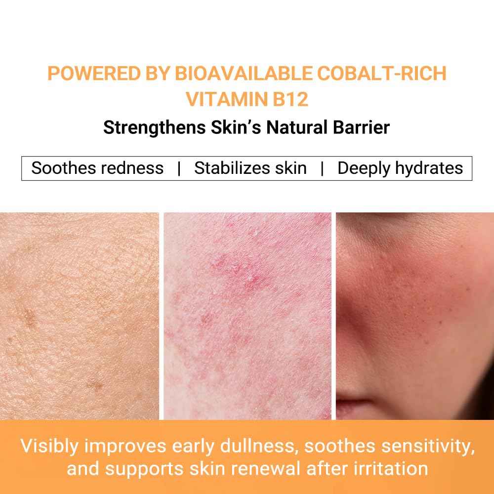 pure.tiful Vitamin B12 Lotion (1 oz) | Repair & Hydrating Cream for All Ages （teen & adult| Soothes Redness, After-Sun Skin Relief, Strengthens Barrier, Sensitive Skin Safe