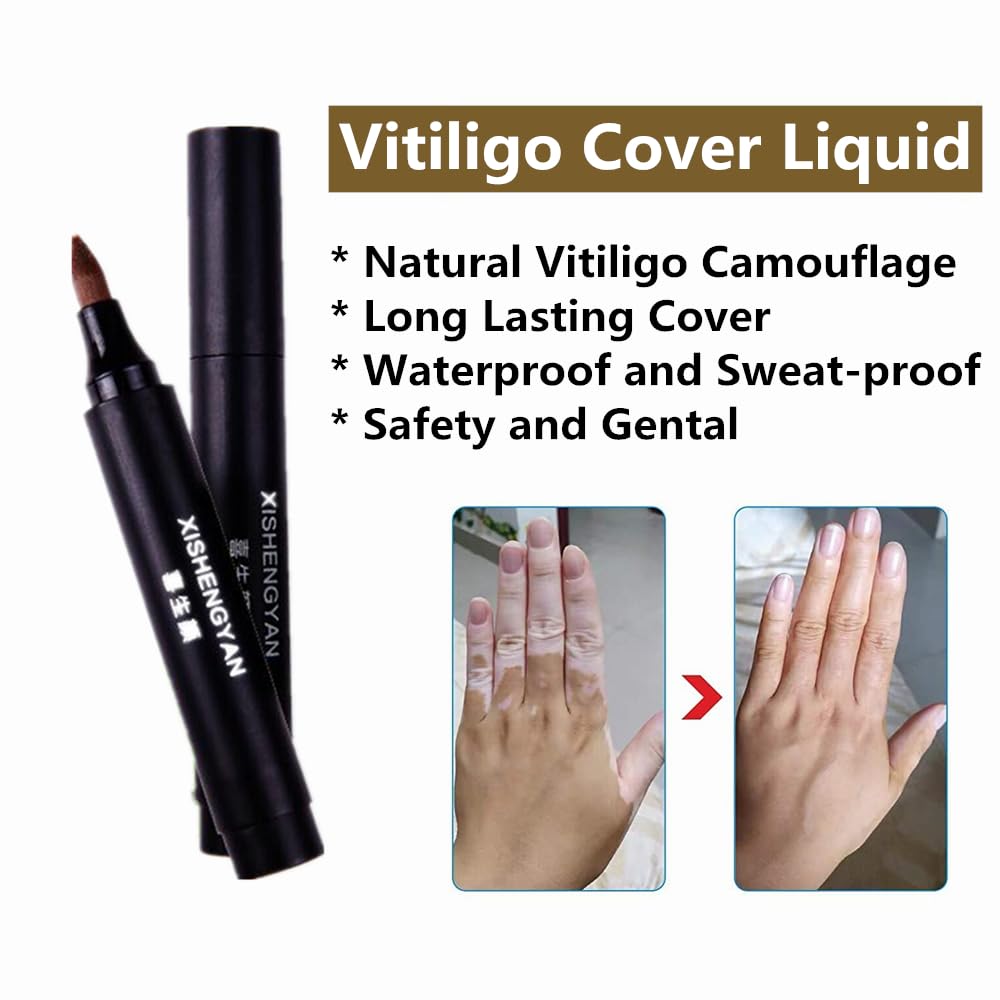 Vitiligo Cover Up Makeup, XISHENGYAN Waterproof Cosmetic Concealer for Skin Vitiligo, Long Lasting White Spots Natural Camouflage Liquid Pen, How to Cover Vitiligo Patches, Use on Face, Hands and Body