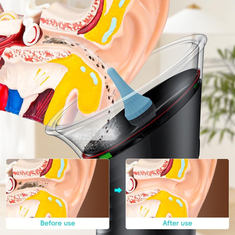Ear Wax Removal with LED Display, Temodu Electric Ear Cleaner, Rechargeable Earwax Remove Removal Ear Irrigation System, 3 Pressure Modes Ear Cleaning Earwax Removal (12 Disposable Tips)-Black