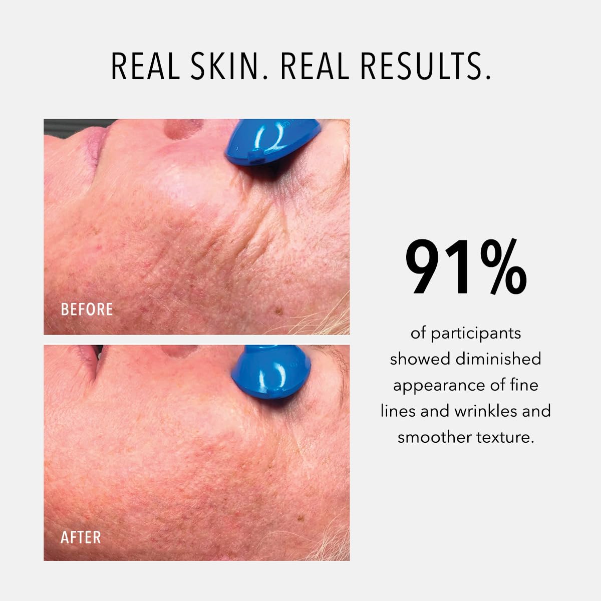 HydroPeptide Nimni Cream - 0.25% Retinol Anti-Aging Booster for Skin Elasticity | 0.5 Ounce