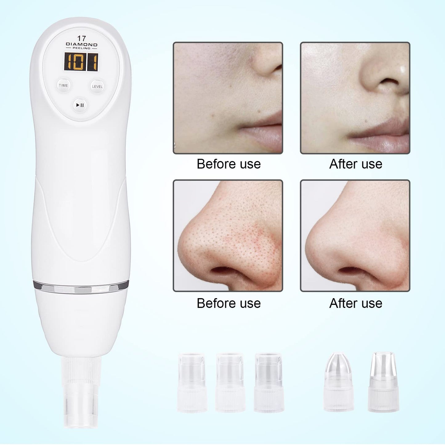 AIMENGXI Diamond Microdermabrasion Machine Professional Blackhead Remover Vacuum Upgraded Facial Pore Cleaner Electric USB with 8 Probes Blackhead Remover Skincare Tool