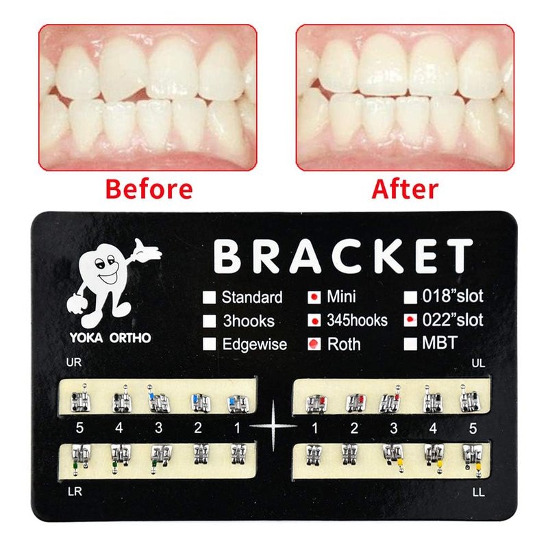 200Pcs Tooth Brace Teeth Model Mini Roth Brackets Roth 022 Slot Bondable with Hook on 347 (200pcs-Black)