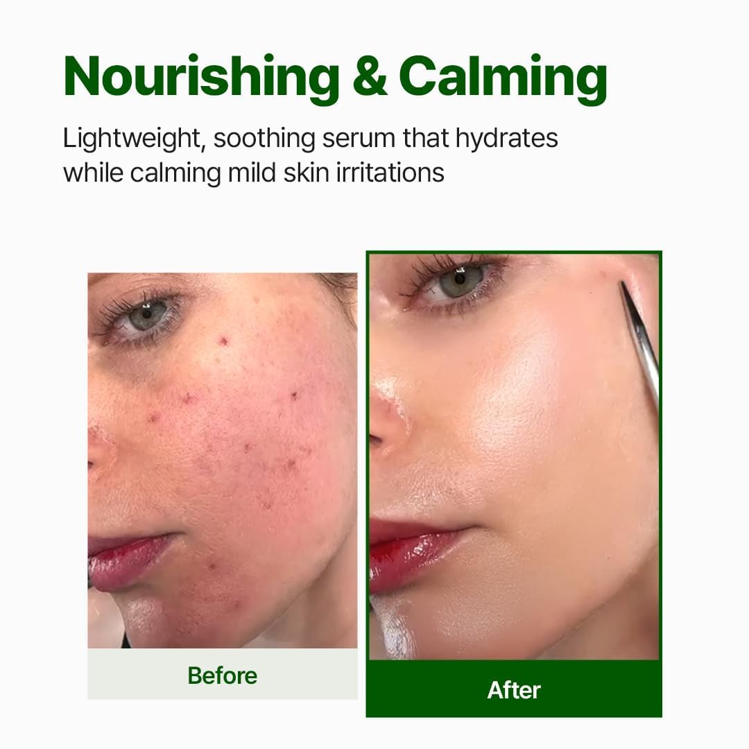 NACIFIC Cica PDRN Centella Serum (Centella Ampoule) 1.69 fl oz / 50ml, Korean Serum for Sensitive Skin, Calming & Hydrating Barrier Repair, Redness Relief, Korean Skincare