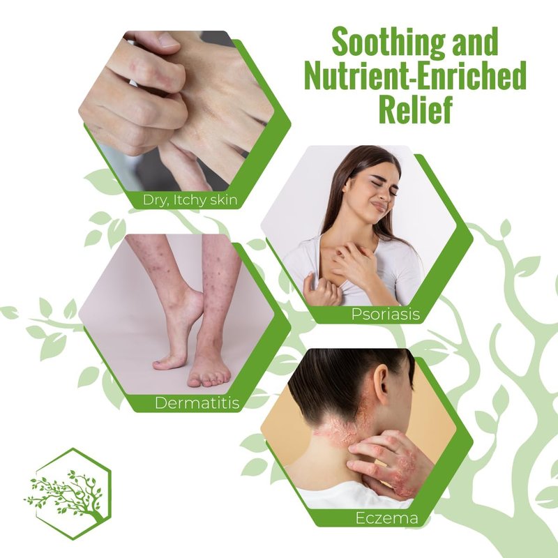 Wild Naturals Moisturizing Eczema Body Wash – Gentle Psoriasis Body Wash for Itchy, Dry Skin Relief – Eczema Soap for Redness and Flareups – Hydrating Cleanser for Women and Men