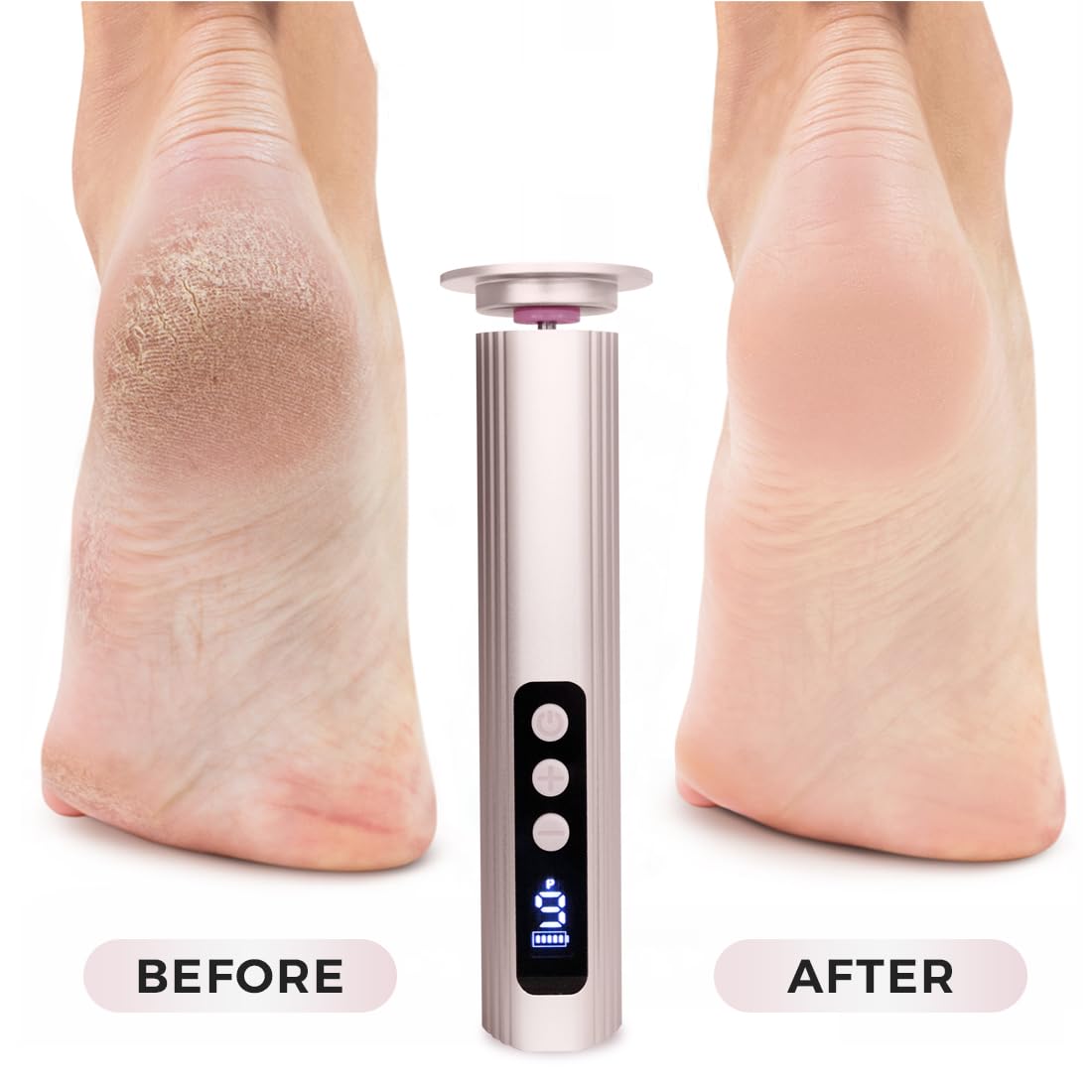 Electric Foot Callus Remover with Nano Glass Head, 9-Speed Rechargeable Foot File with Adjustable R/F Rotation, Digital Display & Powerful Motor for Cracked Heels & Dead Skin (Pink)