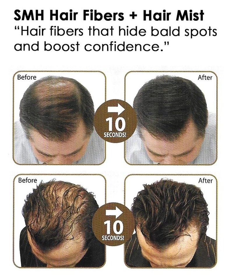 Super Million Hair Fibers - Conceal Thinning Hair Instantly | Long-Lasting, Water & Sweat Resistant - Medium Brown, 15g