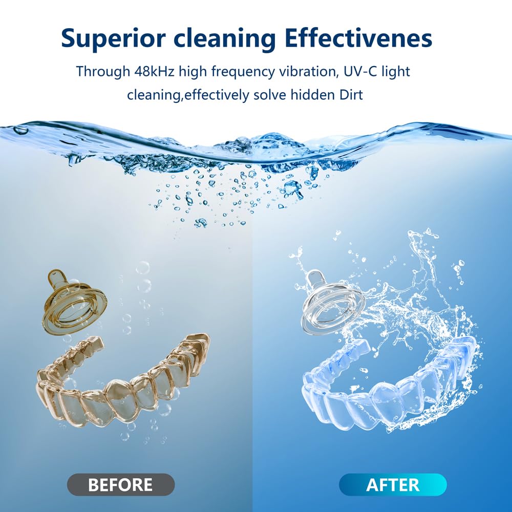500ML Capacity 48kHz, Updated Version Ultrasonic Retainer Cleaner, Multi-Functional Cleaner Machine For Dentures, Mouth Guards, Braces, Toothbrush, Jewelry, Glasses with Alam Clock Function (black)
