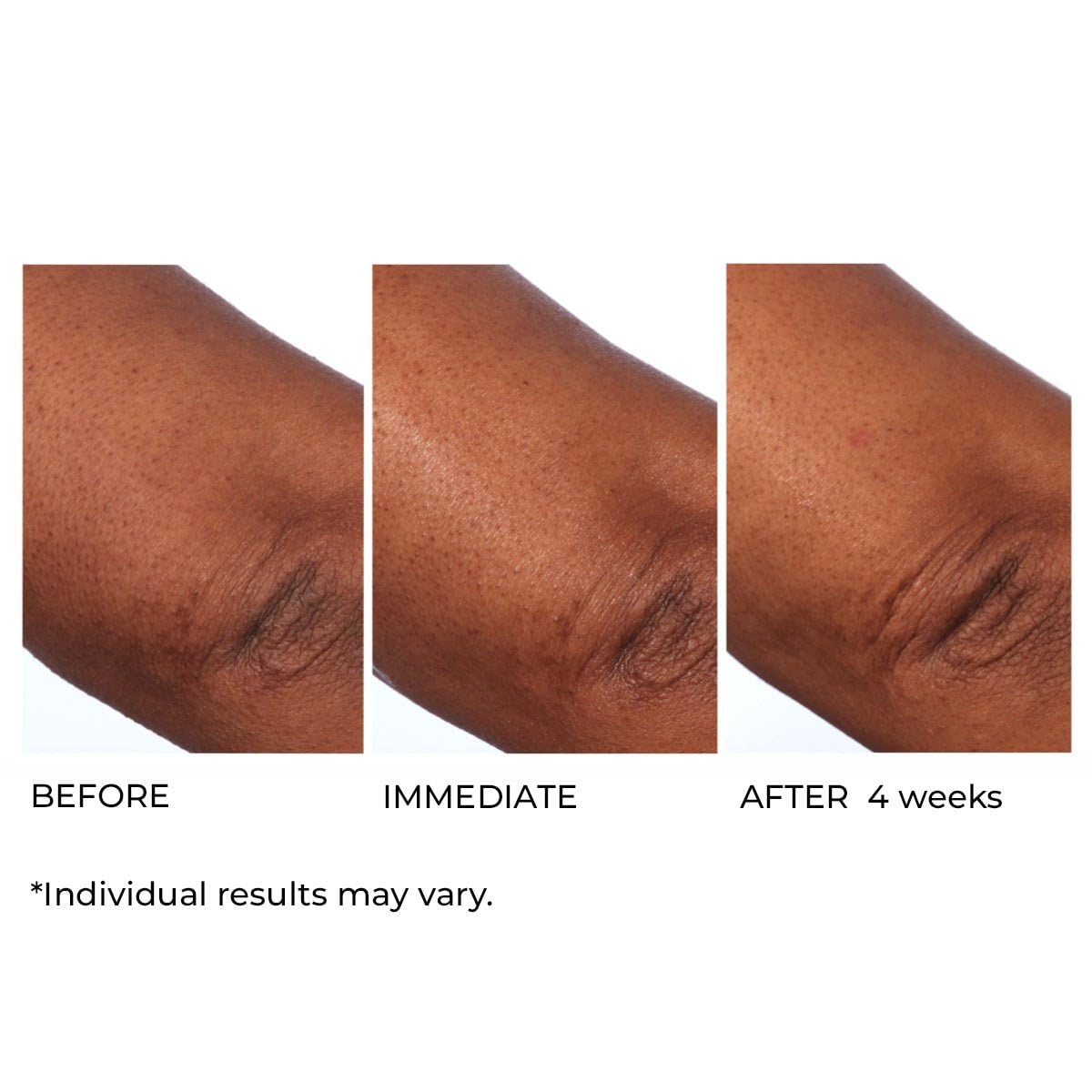 Hydro-Screen Intense Hydration Face & Body Souffle - Nourishing Moisturizer for All Skin Types