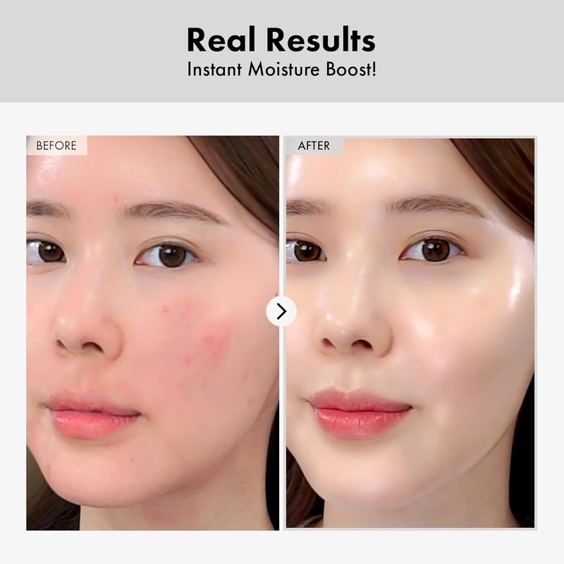 Hyaluronic Acid Ampoule - Hydrating Anti-Aging Face Serum for Dry Skin | Korean Skincare, 100ml