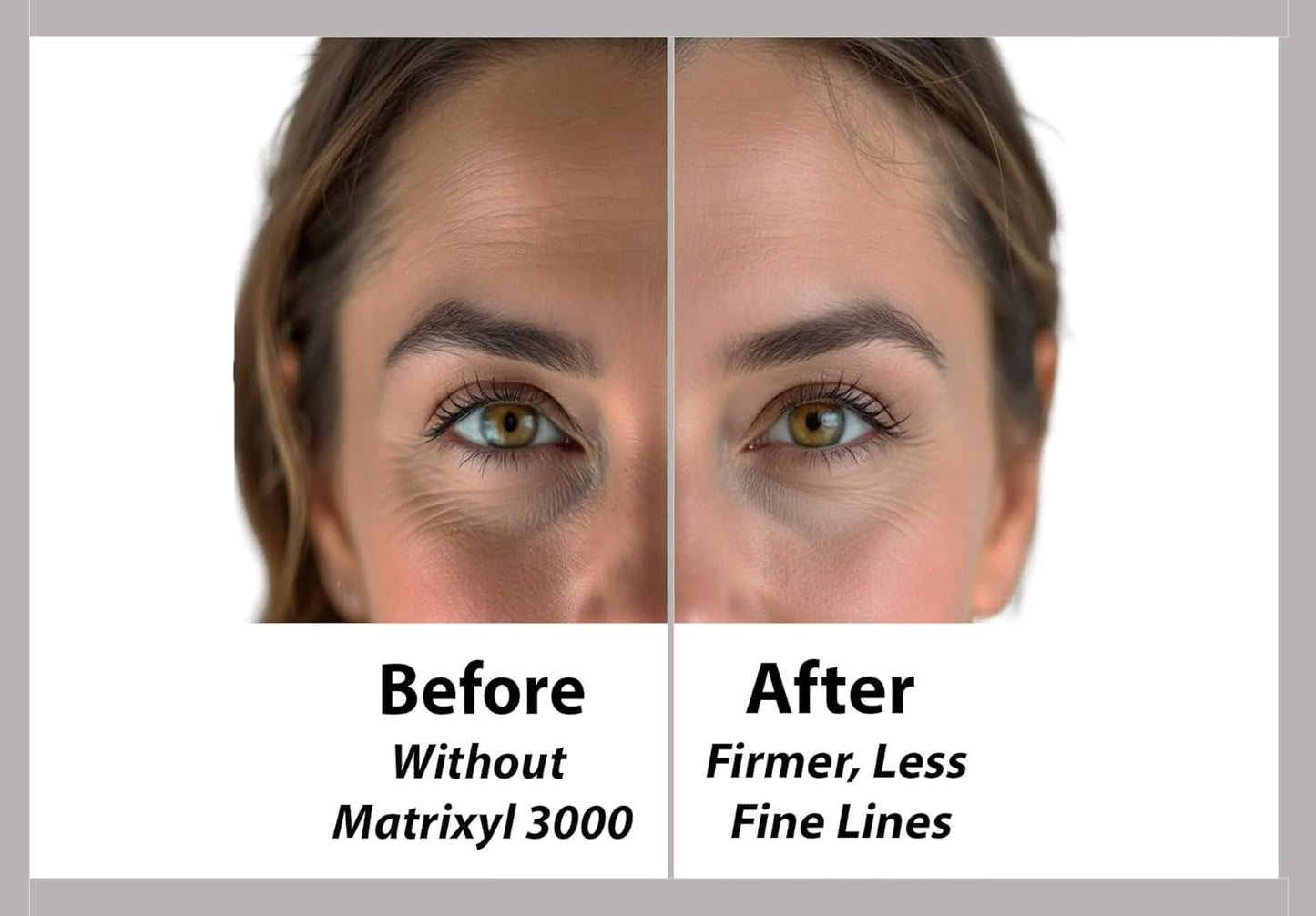 Matrixyl 3000 Firming Eye Cream - Peptide-Rich Formula to Boost Collagen, Reduce Fine Lines & Wrinkles | 1 Fl Oz