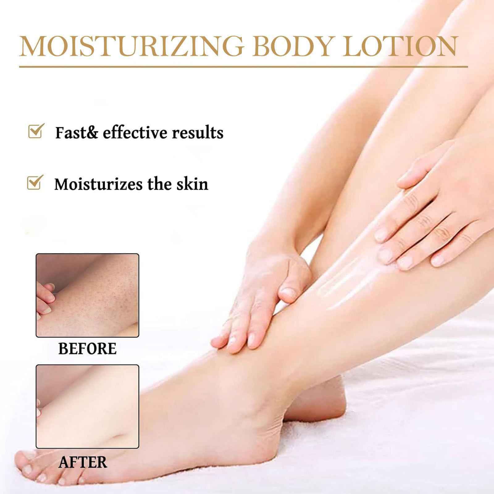 Body Lotion Crema Aclaradora, Moisturizing, Hydrating Bodys Lotions, Lightweight & Non-greasy, For Body, Face, Underarms, Knees & Elbows (2pcs, 3.5fl oz)