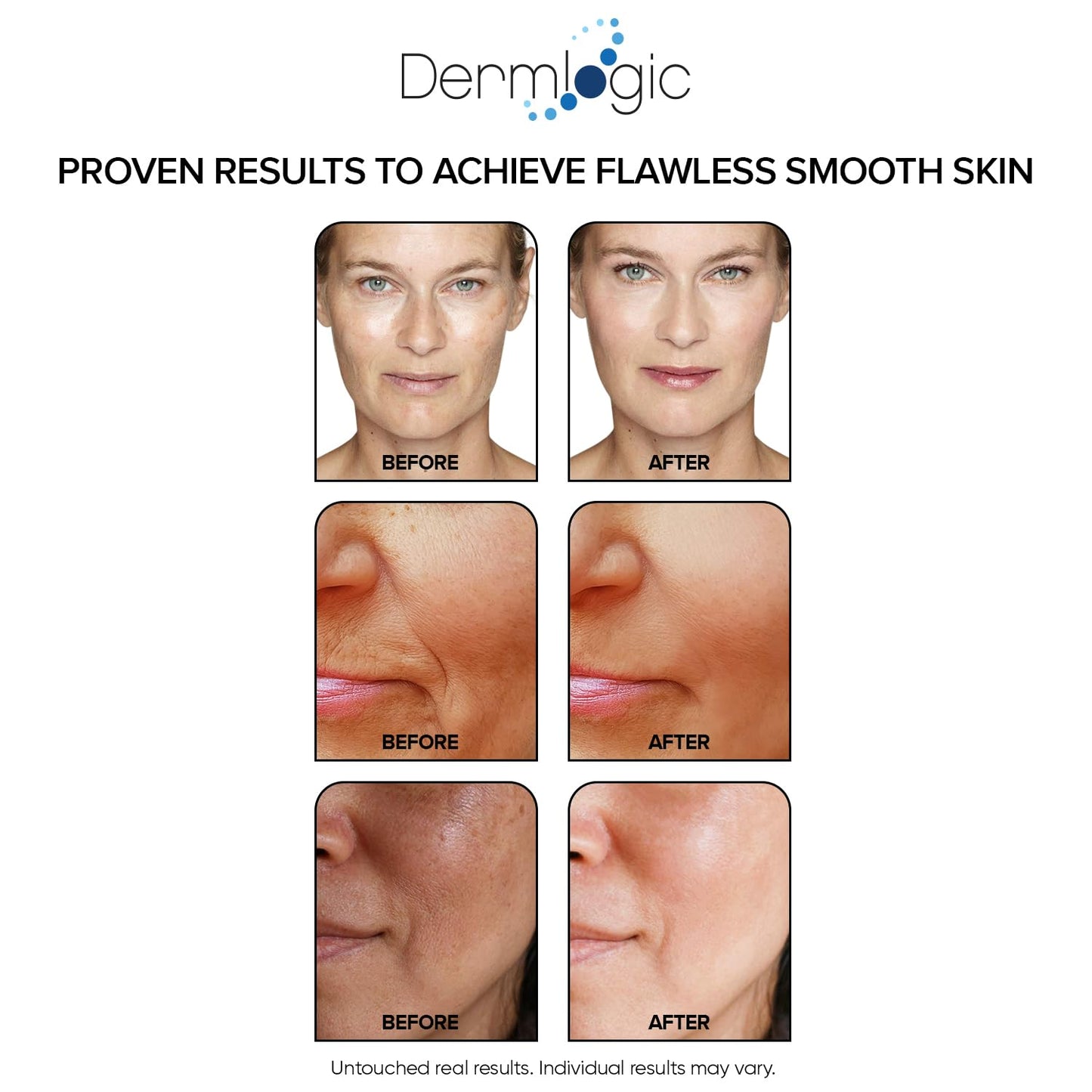 Anti Aging Resurfacing Peel Pads- Triple Action Chemical Peel Pads Combined with Glycolic, Lactic, and Salicylic Acids. Smooth’s Fine Lines, Wrinkles, Dark Spots, and Imperfections to Enhance the Skin
