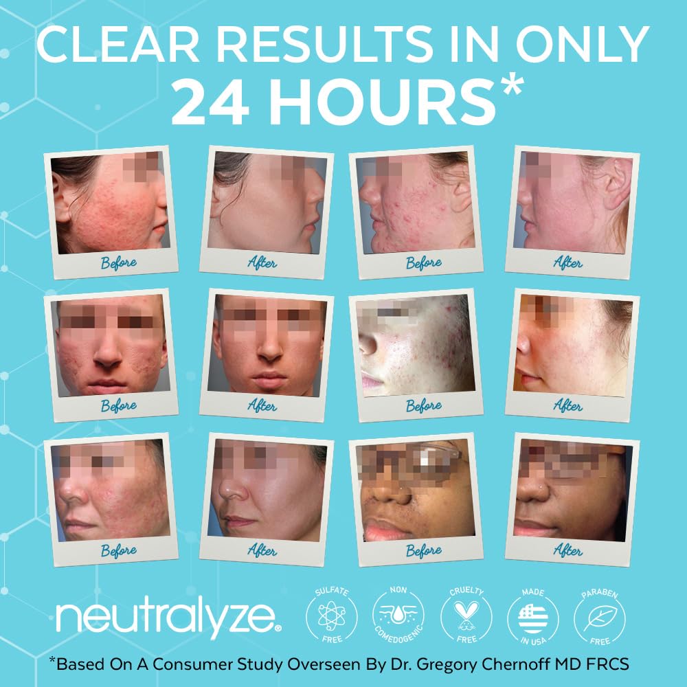 Neutralyze Moderate To Severe Acne Treatment Kit 2.0 (Clearing Serum & Synergyzer)