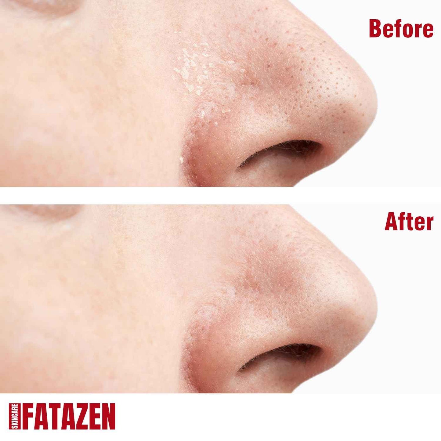 FATAZEN Turmeric Pore Clay Mask - Deep Cleansing Acnes Skincare Facial Mask, Oil Control & Instant Glow for Oily & Dull Skin, Blackhead Gentle Exfoliation with Aloe & Vitamin E, 120g/4.23oz