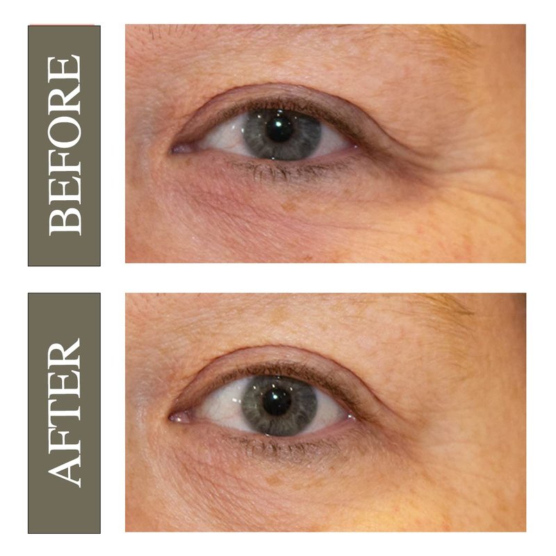 Lifting Eye Serum - Hydrating Under Eye Cream for Dark Circles & Puffiness | Suitable for Sensitive Aging Skin | 0.5 oz.