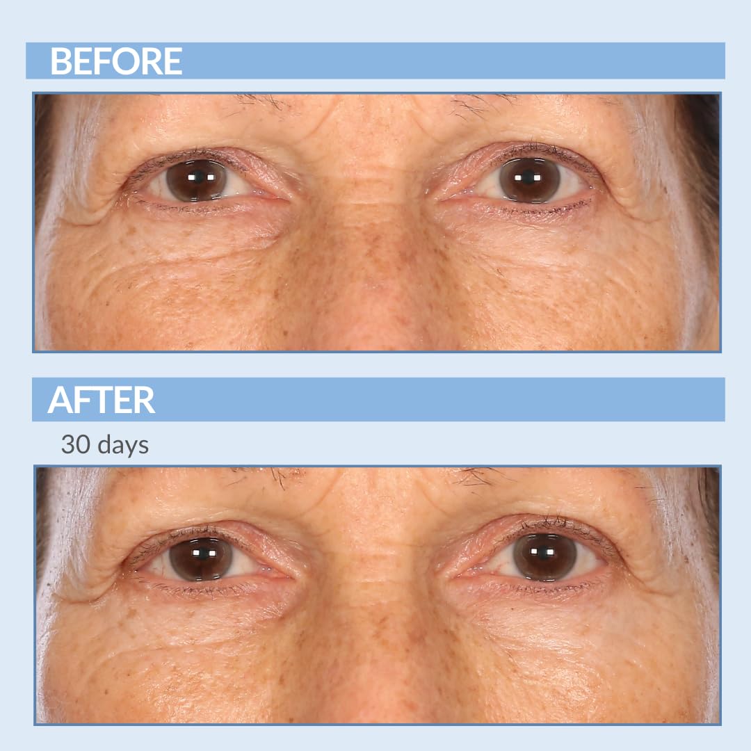 Serious Skincare Retinol A Eye XR Under Eye Cream - Reduce Fine Lines & Dark Circles | 0.5 oz Anti-Aging Treatment