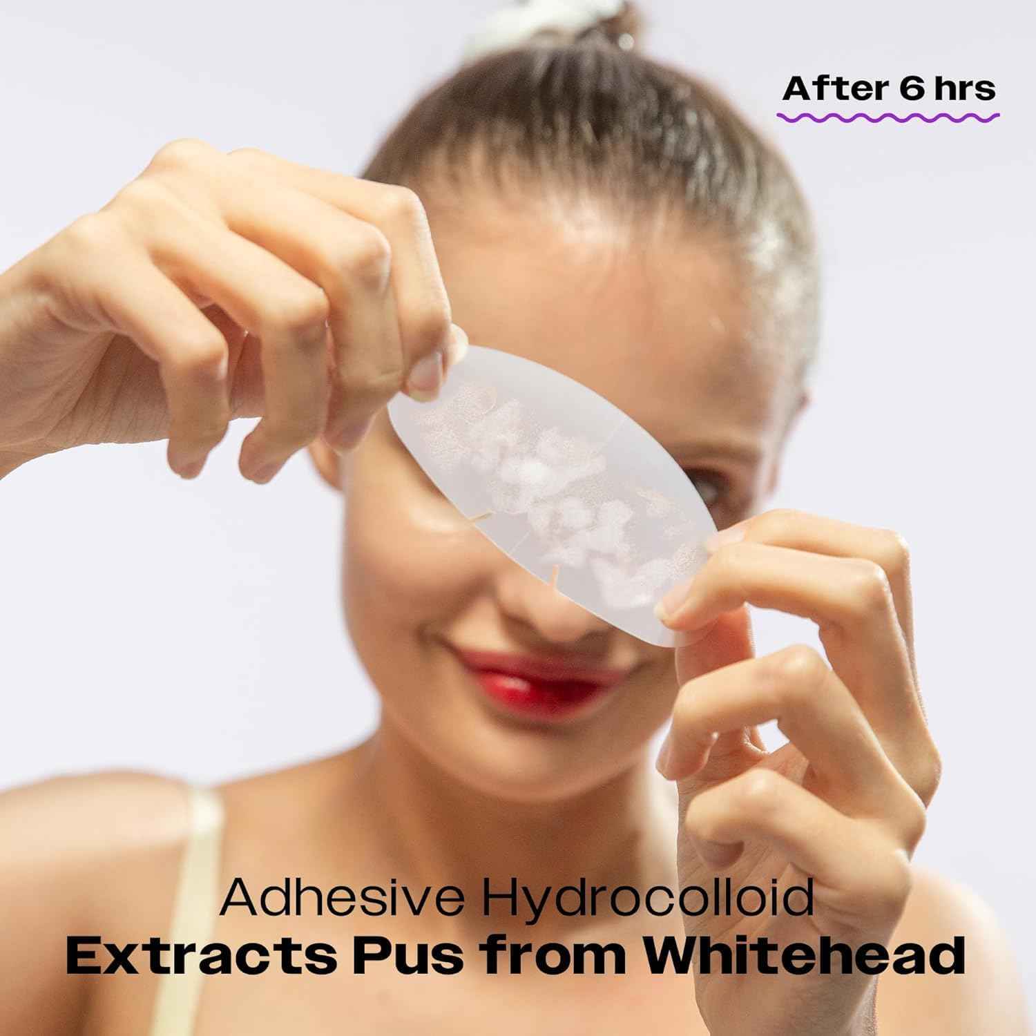 AVARELLE Full Coverage Combo (Nose Ver.) Pimple Patches | Hydrocolloid Acne Patches for Blemishes and Zit for Face, Vegan, Cruelty Free