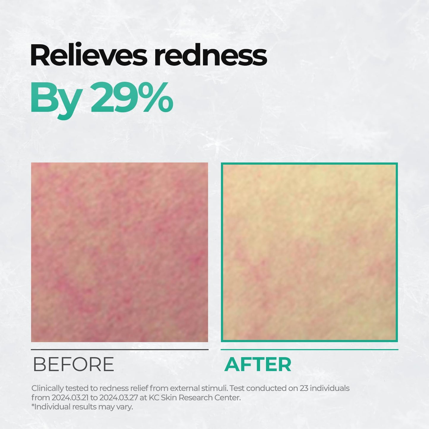 Cell Fusion C Post Alpha Cica Cooling Toner Pad - Redness Relieving & Cooling Korean Toner Pads | Centella Asiatica & Madecassoside | Hydrating, Soothing, Smoothing | 70 Pads / 6.08 fl.oz.