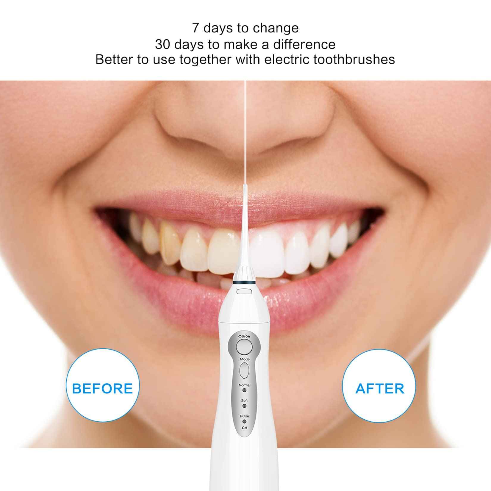 TOVENDOR Electric Water Flosser, Cordless Rechargeable Dental Oral Irrigator IPX7 Waterproof 300ML Travel Water Teeth Cleaner with 5 Tips for Braces Care Teeth Gums Cleaning, Home Office Daily Use