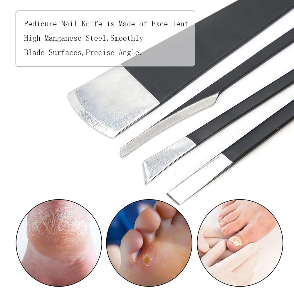 Watris Veiyi 4PCS Pedicure Knife Set, Ingrown Toenail Removal Kit, Pedicure Callus Shaver Tools, Professional Foot Scraper, Steel Foot Care for Dead Skin Corn Foot Remover Foot File Rasp (6.3in)