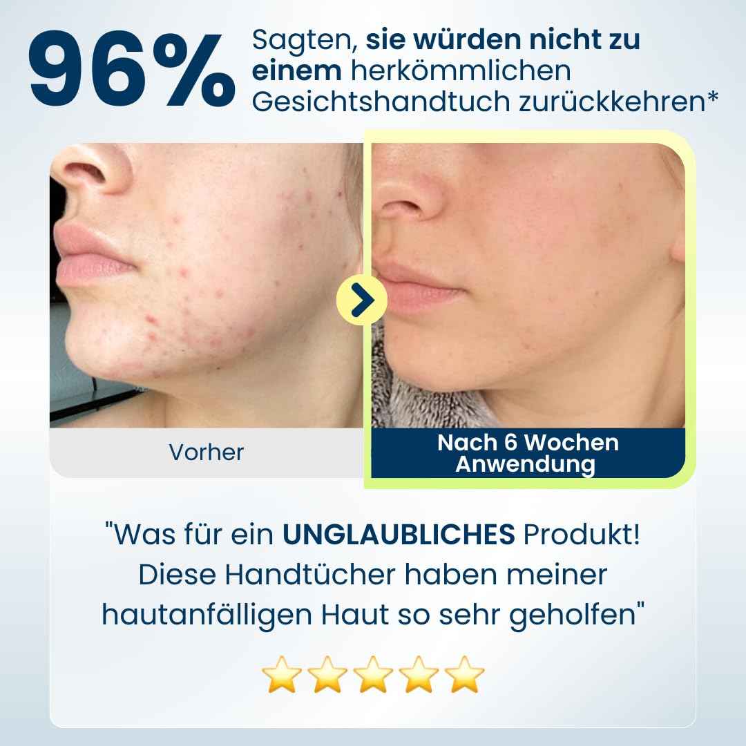 Clean Skin Club Clean Towels®, 100% USDA Biobased Face Towel, Disposable Face Towelette, Eczema Association Accepted, Makeup Remover Dry Wipes, Ultra Soft, 25 ct per pack, 2 Packs, 50 Ct Total