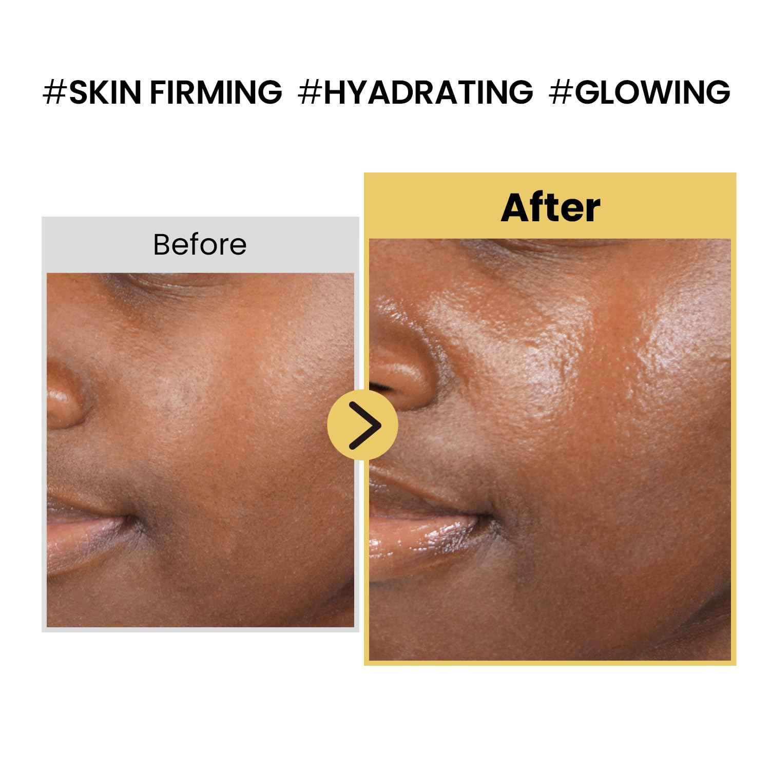 coxir INTENSIVE EGF PEPTIDES CREAM l Day&Night Firming Cream l EGF(Epidermal Growth Factor), Peptides, Niacinamide, Panthenol, Collagen l Korean Skincare [50ml/1.69fl.oz]